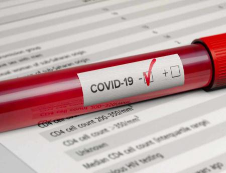 В Минздраве рассказали, нужно ли прививаться переболевшим COVID-19
