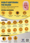 Будьте бдительны: рак языка!